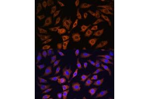 Immunofluorescence analysis of L929 cells using 14-3-3 alpha/beta antibody (ABIN3021284, ABIN3021285, ABIN3021286 and ABIN6214397) at dilution of 1:100. (YWHAB antibody  (AA 1-246))