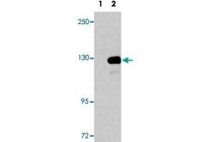 Western blot analysis of UPF1 (arrow) using UPF1 polyclonal antibody . (RENT1/UPF1 antibody  (AA 7-37))