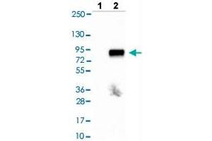 Western blot analysis of Lane 1: Negative control (vector only transfected HEK293T lysate), Lane 2: Over-expression lysate (Co-expressed with a C-terminal myc-DDK tag (~3. (Tyrosinase-Related Protein 1 antibody  (AA 257-377))