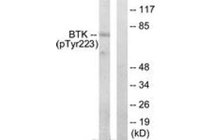 Western blot analysis of extracts from HeLa cells treated with Serum 10% 15', using BTK (Phospho-Tyr223) Antibody. (BTK antibody  (pTyr223))