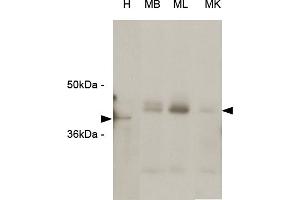 Western blot analysis The extracts of HeLa (H) cells , mouse brain (MB), mouse liver (ML) and mouse kidney (MK) tissues (each 20 ug) were resolved by SDS-PAGE, transferred to PVDF membrane and probed with anti-human RASSF1A (1:1000). (RASSF1 antibody  (Isoform A, N-Term))