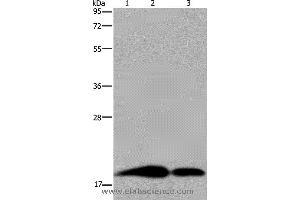 Western blot analysis of Human brain malignant glioma, mouse kidney and human kidney tissue, using REG3G Polyclonal Antibody at dilution of 1:250