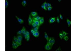 Immunofluorescence staining of HepG2 cells with ABIN7177734 at 1:133, counter-stained with DAPI. (Perforin 1 antibody  (AA 21-554))