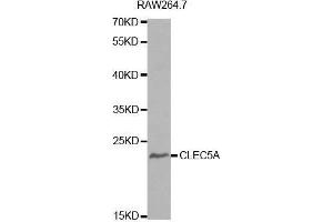 Western blot analysis of extracts of RAW264. (CLEC5A antibody  (AA 29-188))