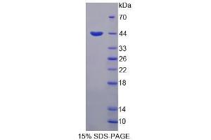 Image no. 1 for Homeodomain Interacting Protein Kinase 4 (HIPK4) (AA 288-616) protein (His tag) (ABIN6239714) (HIPK4 Protein (AA 288-616) (His tag))