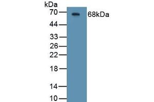 Detection of Recombinant CFTR, Human using Polyclonal Antibody to Cystic Fibrosis Transmembrane Conductance Regulator (CFTR) (CFTR antibody)