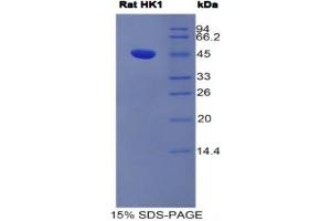 SDS-PAGE analysis of Rat Hexokinase 1 Protein.