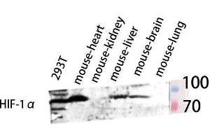 Western Blot (WB) analysis of 293T Mouse Brain Mouse Spleen Mouse Heart lysis using HIF-1alpha antibody. (HIF1A antibody  (Internal Region))