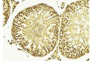 ABIN6266600 at 1/100 staining Mouse testis tissue by IHC-P. (NKX3-1 antibody  (Internal Region))