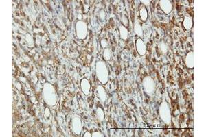 Image no. 3 for anti-Eukaryotic Translation Initiation Factor 5 (EIF5) (AA 1-432) antibody (ABIN598657) (EIF5 antibody  (AA 1-432))