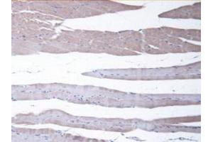 Detection of CBR1 in Mouse Skeletal Muscle Tissue using Polyclonal Antibody to Carbonyl Reductase 1 (CBR1) (CBR1 antibody  (AA 66-271))