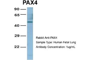 Host:  Rabbit  Target Name:  PAX4  Sample Type:  Human Fetal Lung  Antibody Dilution:  1. (PAX4 antibody  (Middle Region))