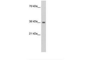 Image no. 1 for anti-Phytanoyl-CoA 2-Hydroxylase Interacting Protein (PHYHIP) (AA 101-150) antibody (ABIN204948) (PHYHIP antibody  (AA 101-150))