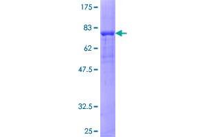 PRKAR2A Protein (AA 1-382) (GST tag)