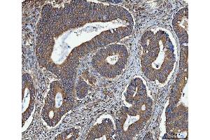 IHC analysis of TRMT61B using anti-TRMT61B antibody (ABIN7602334). (TRMT61B antibody  (AA 7-477))