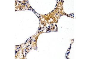 Immunohistochemistry of paraffin-embedded rat lung using MT2A antibody at dilution of 1:200 (400x lens). (MT2A antibody)