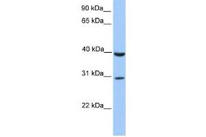 Western Blotting (WB) image for anti-JAZF Zinc Finger 1 (JAZF1) antibody (ABIN2458461)