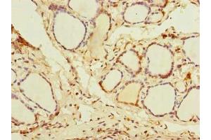 Immunohistochemistry of paraffin-embedded human thyroid tissue using ABIN7144994 at dilution of 1:100 (DDX5 antibody  (AA 1-210))