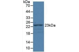 Detection of Recombinant FBLN1, Rat using Monoclonal Antibody to Fibulin 1 (FBLN1)