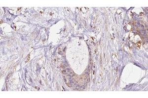 EXOC1 antibody  (N-Term)