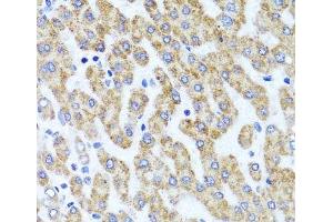 Immunohistochemistry of paraffin-embedded Human liver damage using INADL Polyclonal Antibody at dilution of 1:100 (40x lens). (PATJ antibody)
