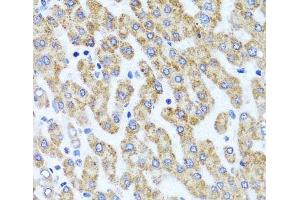 Immunohistochemistry of paraffin-embedded Human liver damage using INADL Polyclonal Antibody at dilution of 1:100 (40x lens).