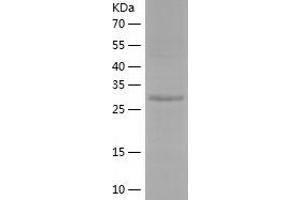 Western Blotting (WB) image for AlkB, Alkylation Repair Homolog 2 (ALKBH2) (AA 1-261) protein (His tag) (ABIN7121792) (ALKBH2 Protein (AA 1-261) (His tag))