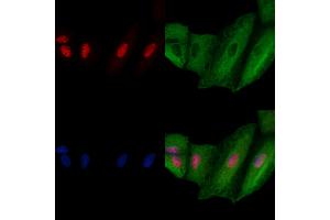ABIN6264927 and ABIN6278743 staining  cells by IF/ICC.