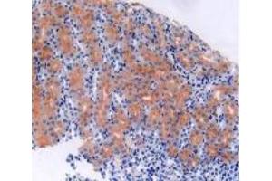 Figure. (S100B antibody  (AA 1-92))