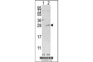 Western blot analysis of AK3 using rabbit polyclonal AK3 Antibody (C-term H38) using 293 cell lysates (2 ug/lane) either nontransfected (Lane 1) or transiently transfected with the AK3 gene (Lane 2).