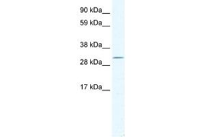 WB Suggested Anti-DMRT2 Antibody Titration:  2.