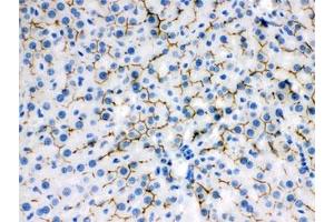 IHC testing of FFPE rat liver with ABCB11 antibody. (ABCB11 antibody)