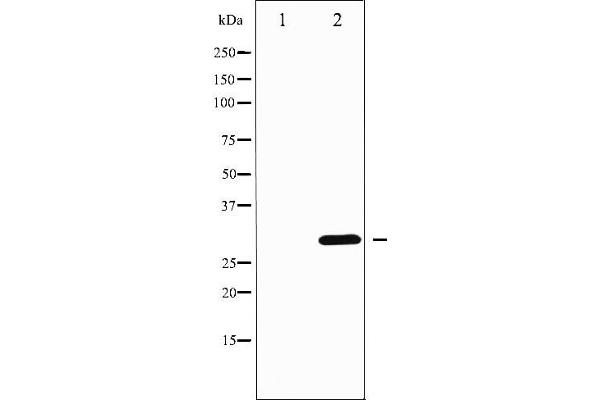 DARPP32 antibody  (pThr75)