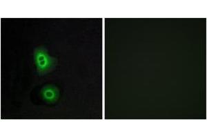 Immunofluorescence analysis of A549 cells, using OR4C16 Antibody. (OR4C16 antibody  (AA 261-310))