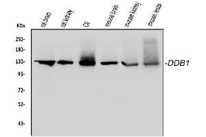Western blot analysis of DDB1 using anti-DDB1 antibody (ABIN3043823). (DDB1 antibody  (AA 1011-1140))