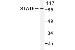 Image no. 1 for anti-Signal Transducer and Activator of Transcription 6, Interleukin-4 Induced (STAT6) antibody (ABIN271832)