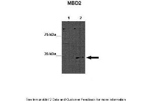 Lanes:   Lane 1: 15ug WT mouse ES lysate Lane 2: 15ug MBD2 KO mouse ES lysate  Primary Antibody Dilution:   1:1000  Secondary Antibody:   Goat anti-rabbit-HRP  Secondary Antibody Dilution:   1:2500  Gene Name:   MBD2 a  Submitted by:   Austin J.