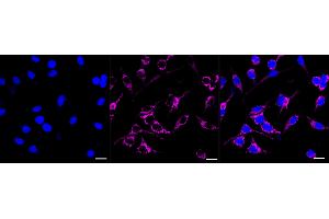 anti-Hematopoietically Expressed Homeobox (HHEX) antibody