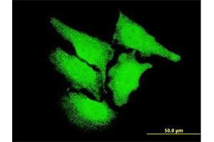 Immunofluorescence of monoclonal antibody to CAMK2D on HeLa cell. (CAMK2D antibody  (AA 301-410))