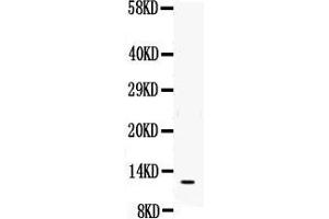 Western blot analysis of MIF using anti- MIF antibody .
