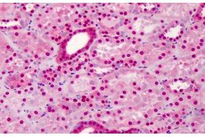 Human Kidney: Formalin-Fixed, Paraffin-Embedded (FFPE) (COPS5 antibody)