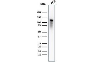 Western Blot Analysis of PC3 cell lysate using Drebrin-1 Mouse Monoclonal Antibody (DBN1/2880). (DBN1 antibody  (AA 150-281))