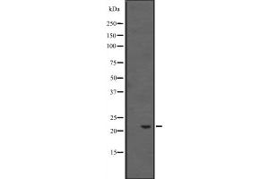 Western blot analysis of HSPB8 expression in Rat skeletal muscle lysate;,The lane on the left is treated with the antigen-specific peptide. (HSPB8 antibody  (C-Term))