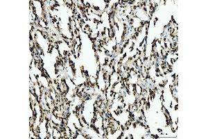 IHC analysis of SFPQ using anti-SFPQ antibody (ABIN7603089).
