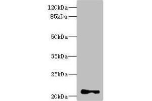 Western blot All lanes: TNNI2 antibody at 3. (TNNI2 antibody  (AA 1-100))