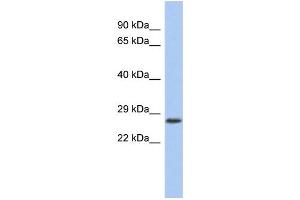 WB Suggested Anti-VENTX Antibody Titration:  0. (VENTX antibody  (Middle Region))