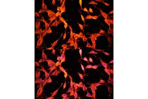 Immunofluorescence analysis of NIH/3T3 cells using MSP/MST1 antibody (ABIN6132374, ABIN6144095, ABIN6144096 and ABIN6216790) at dilution of 1:100. (MST1 antibody  (AA 200-500))