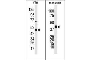 Image no. 1 for anti-Aldehyde Dehydrogenase 3 Family, Member A1 (ALDH3A1) (Middle Region) antibody (ABIN360203) (ALDH3A1 antibody  (Middle Region))