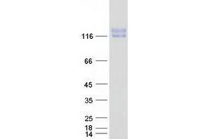 Western Blotting (WB) image for Glutamyl Aminopeptidase (Aminopeptidase A) (ENPEP) protein (Myc-DYKDDDDK Tag) (ABIN2713539)