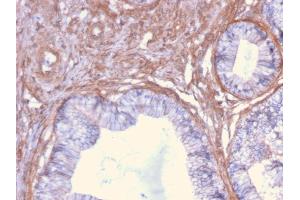 Immunohistochemistry (IHC) image for anti-Drebrin 1 (DBN1) (AA 150-281) antibody (ABIN6939227)